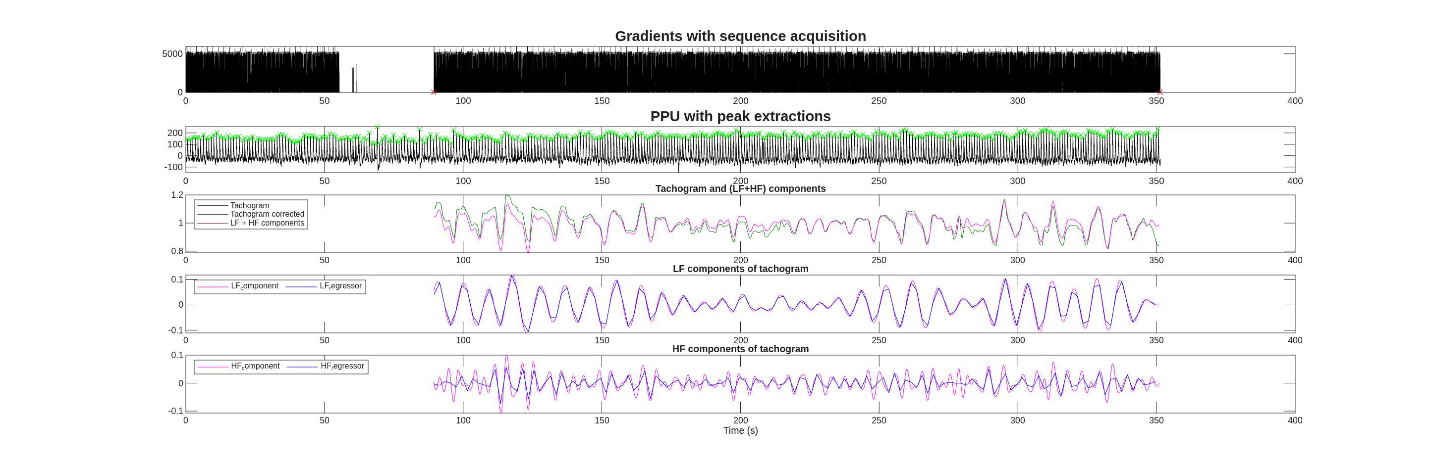 HRV scanphyslog QC plots