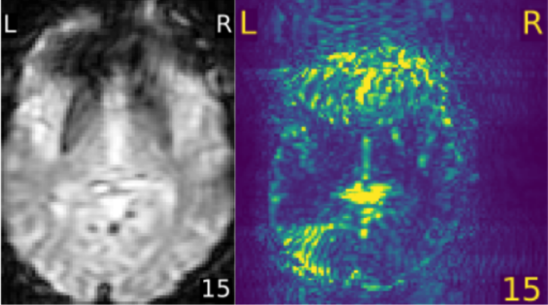 fMRI aliasing