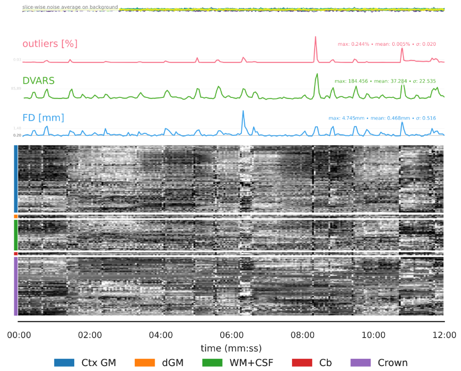 fMRI movements carpetplot