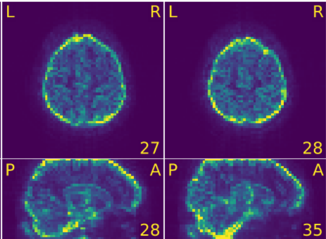 fMRI movements sdt