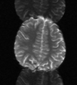 fMRI nyquist