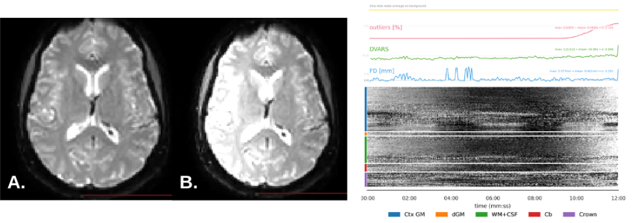 fMRI signal drift