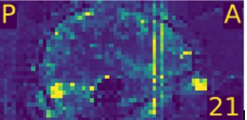 fMRI std map