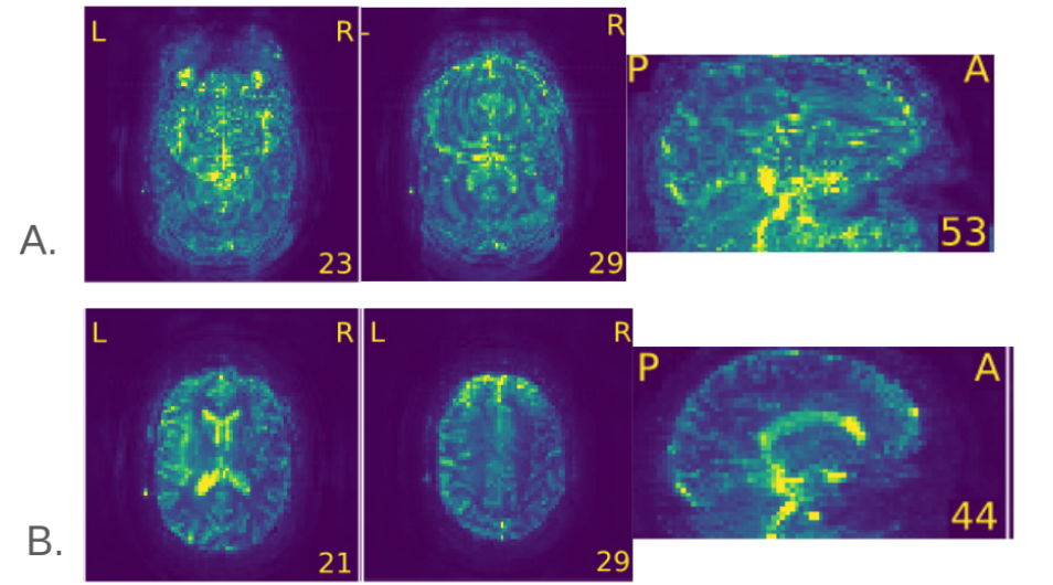 fMRI std map 2